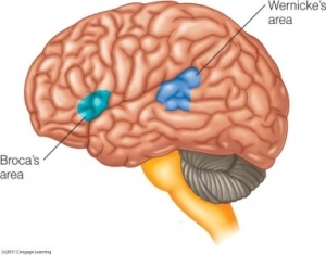 Wernicke Broca